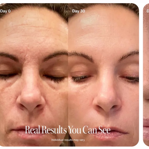 Solowave Bundle Skincare Wand Red Light Therapy Rose Gold & LightBoost Serum NWB - Picture 12 of 15